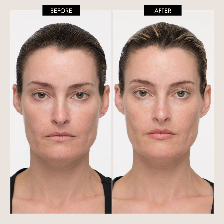 MyoLift™ QT Plus Facial Toning Device