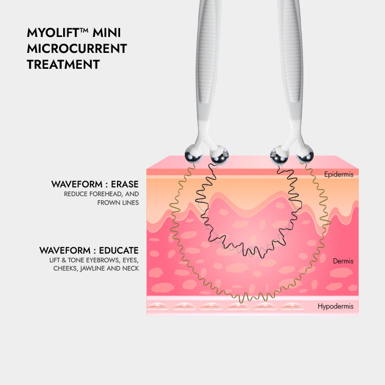 MyoLift Mini Bundle of Joy